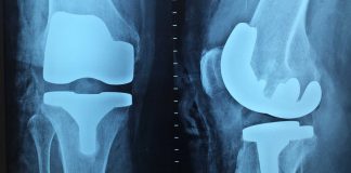 Advantages-of-Cloud-Based-Medical-Software-on-FocusEverything