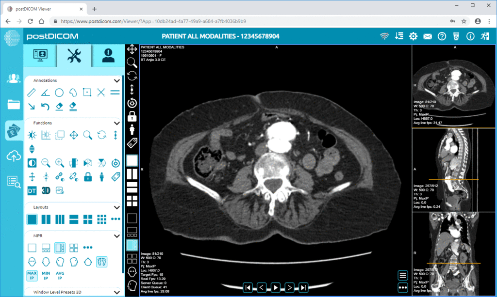 Free DICOM viewers