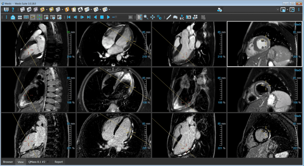 online MRI viewer